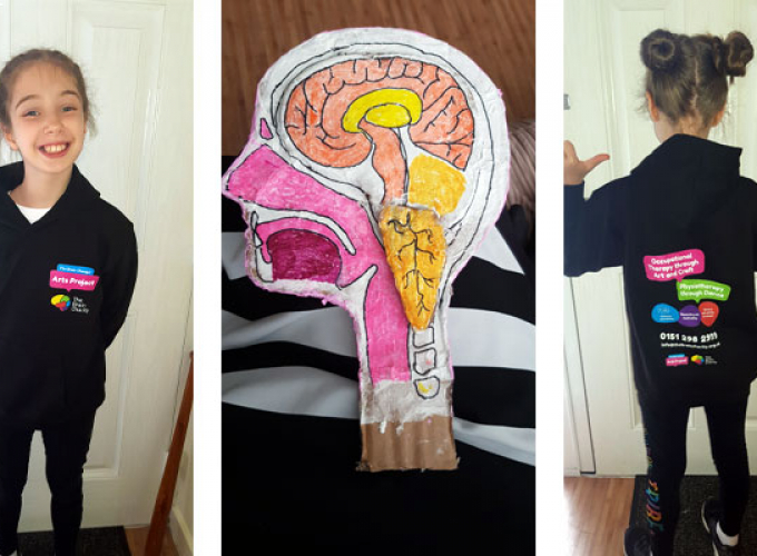 Chiari malformation The Brain Charity