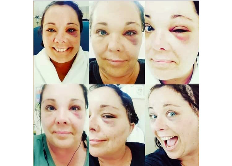 Changing faces post surgery