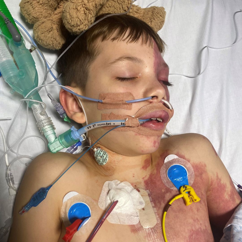 Isaac in hospital following his operation