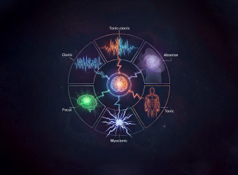 Illustration of seizure types