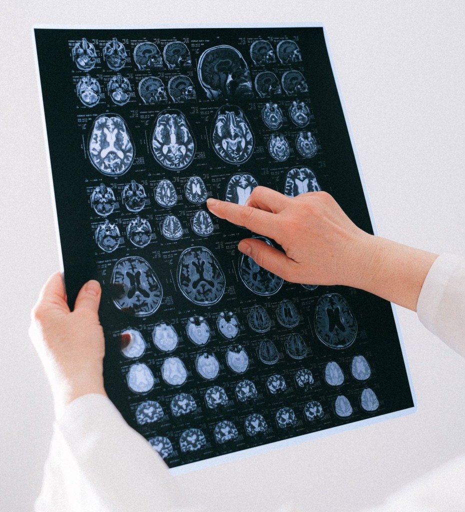 Doctor looking at brain scans.